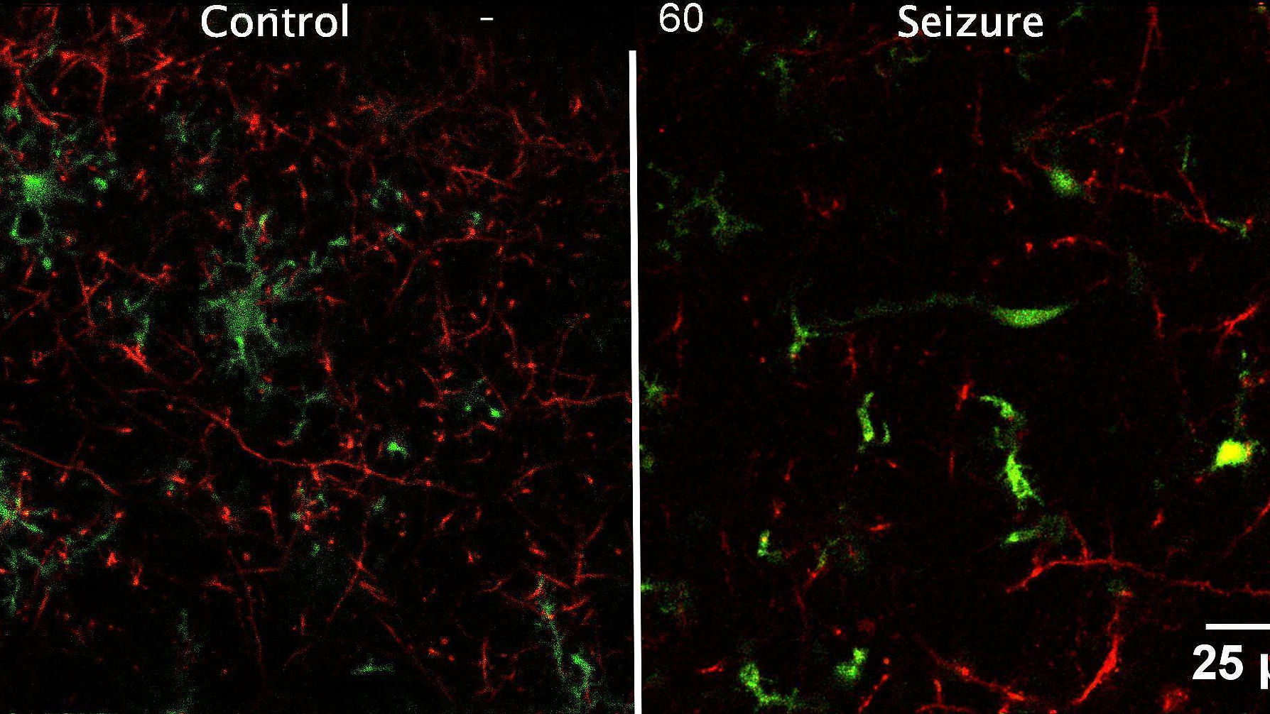 Microglial Process Pouches Target Beaded Dendrites After Seizures